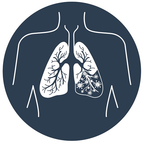 Lung disease