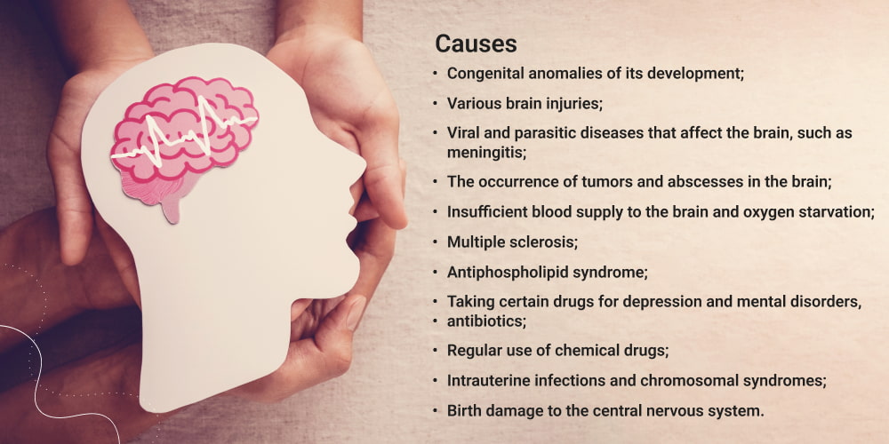 what causes epilepsy?